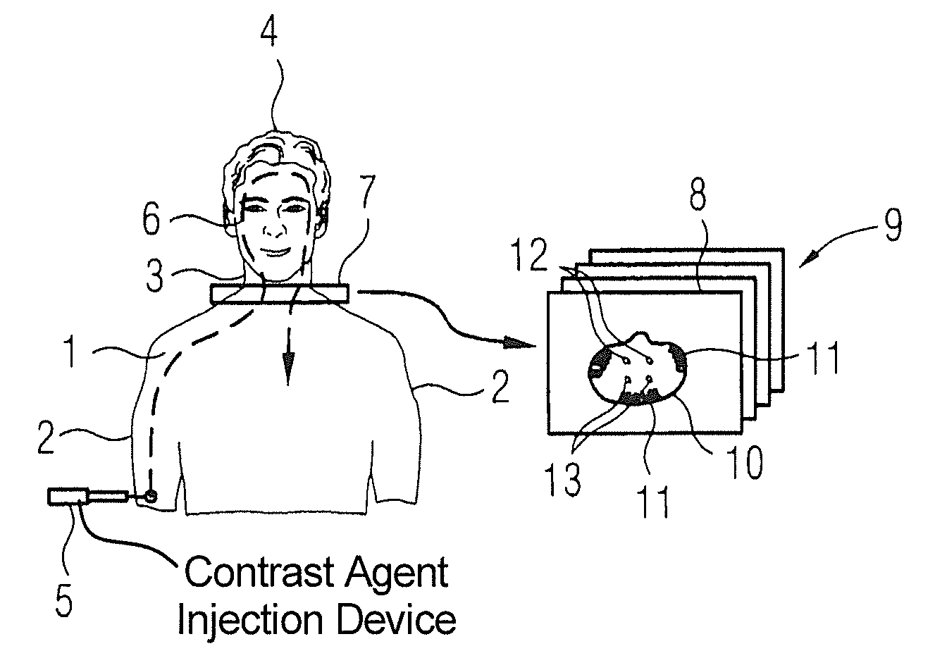 Medical imaging device and method to evaluate a test bolus image series