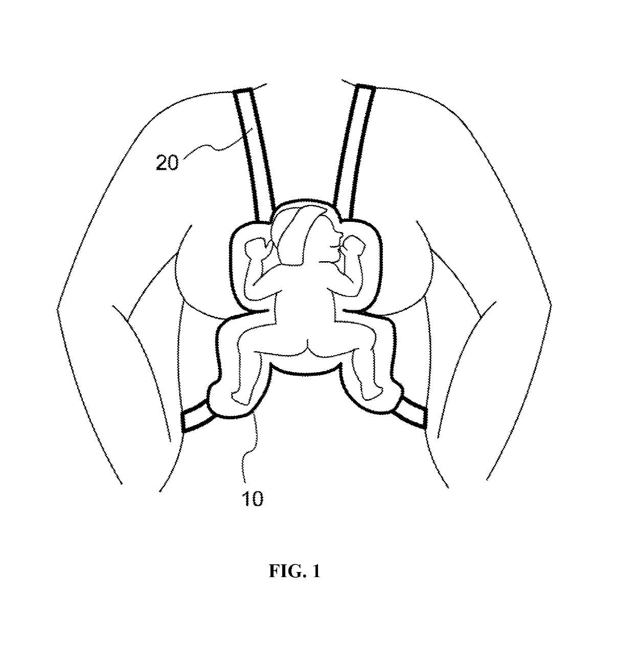 Infant Care Apparatus and System