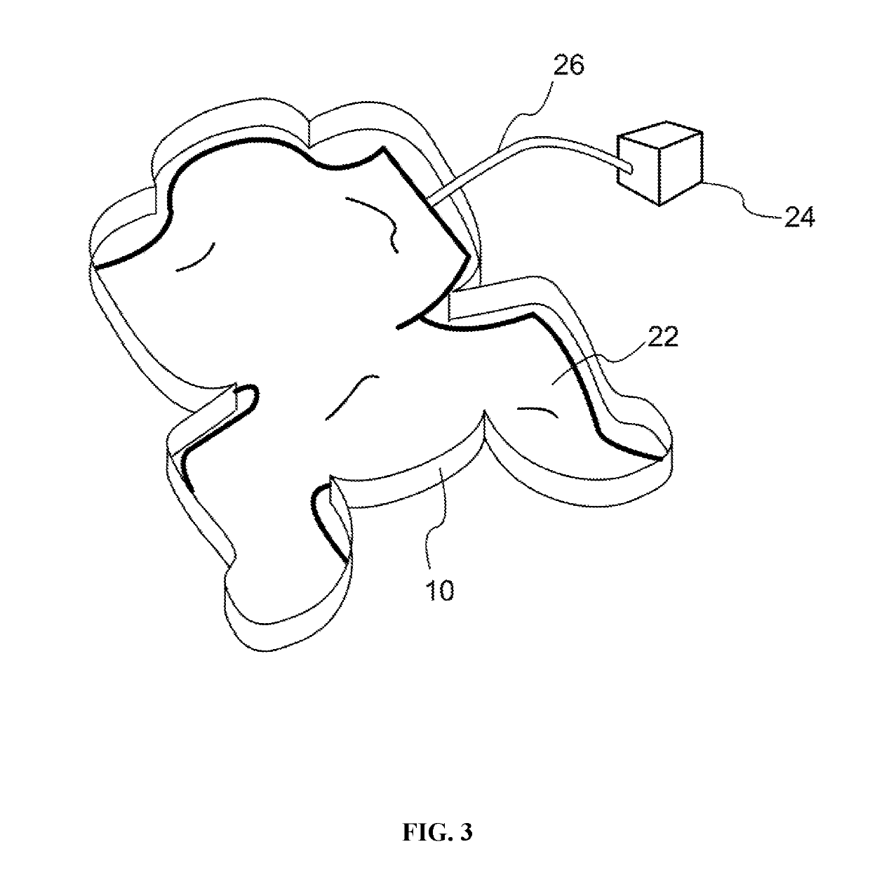 Infant Care Apparatus and System