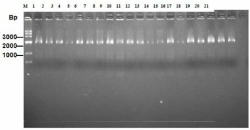 Polypeptide for specifically binding to positive serum of mycoplasma pneumoniae and diagnosis kit