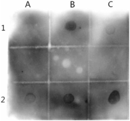 Polypeptide for specifically binding to positive serum of mycoplasma pneumoniae and diagnosis kit