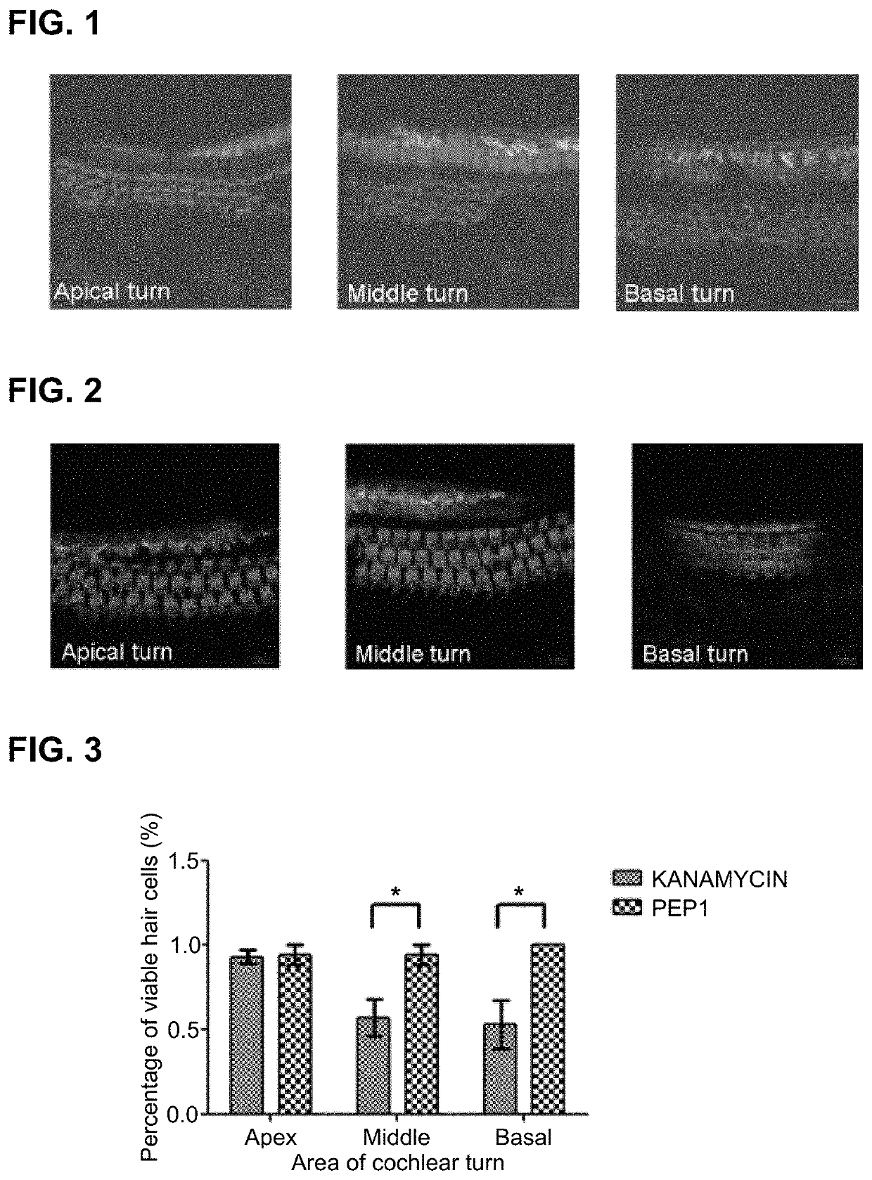 Peptide for preventing hearing loss, and composition comprising same