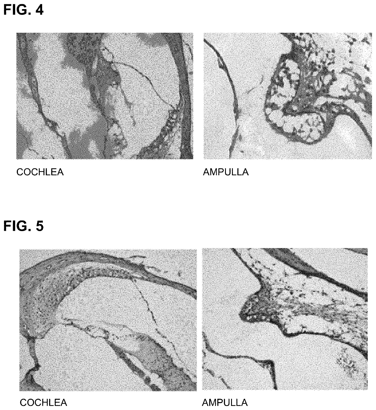 Peptide for preventing hearing loss, and composition comprising same