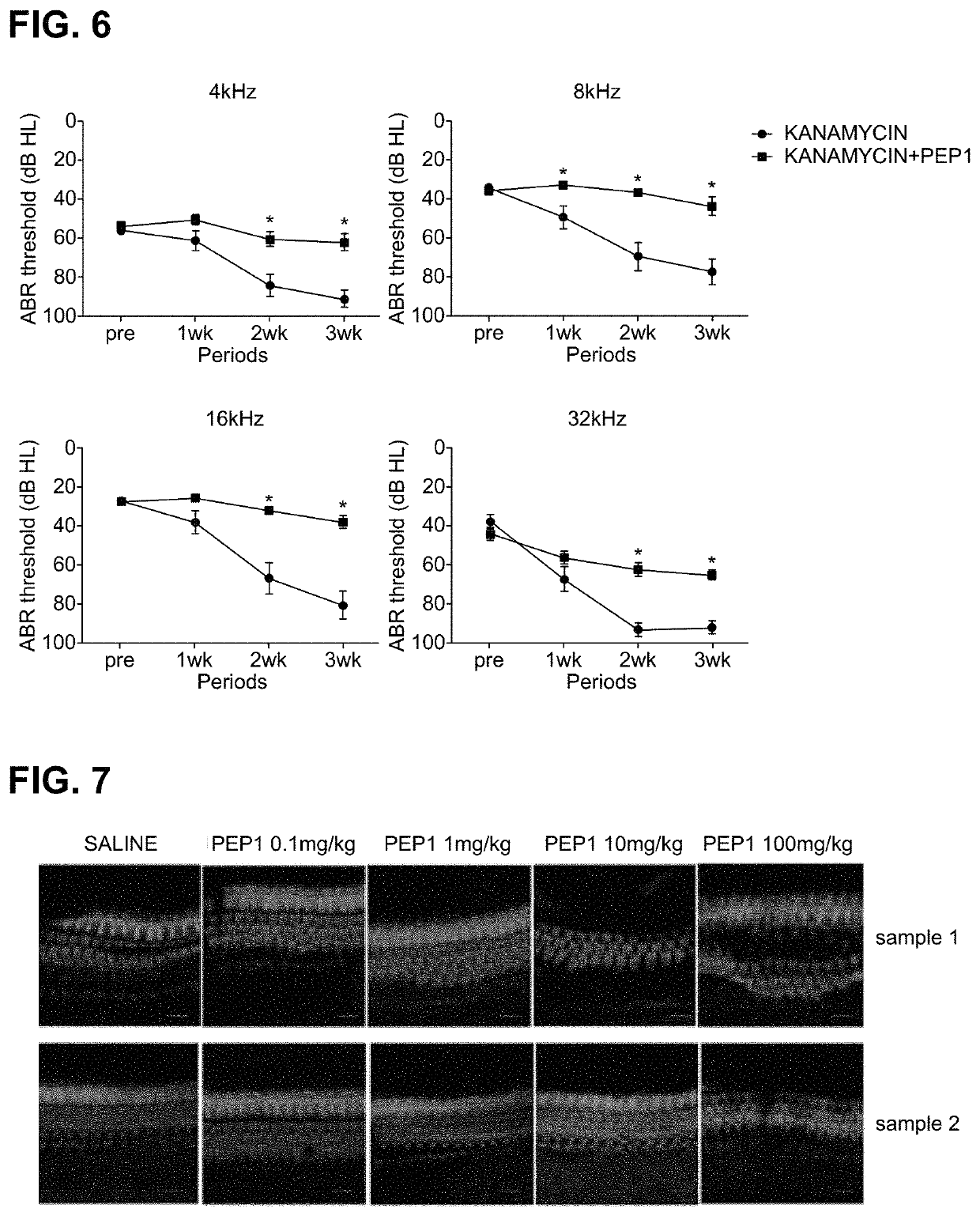 Peptide for preventing hearing loss, and composition comprising same