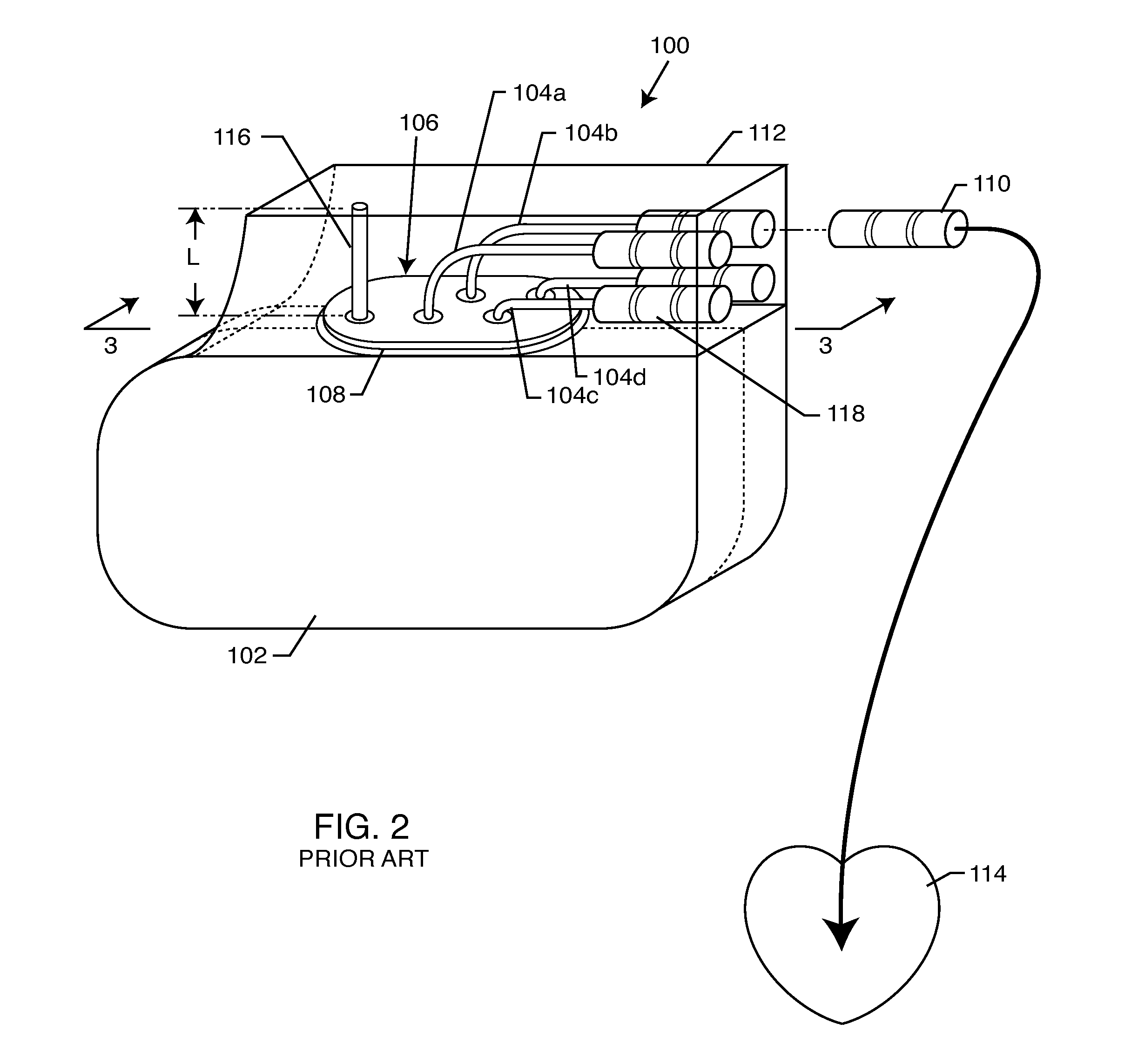 Integrated tank filter for a medical therapeutic device