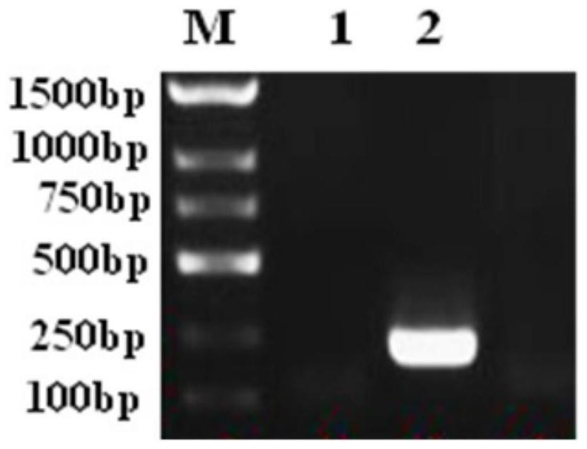 Fluorescent probe primer group and kit for African swine fever virus P72 gene, and application thereof