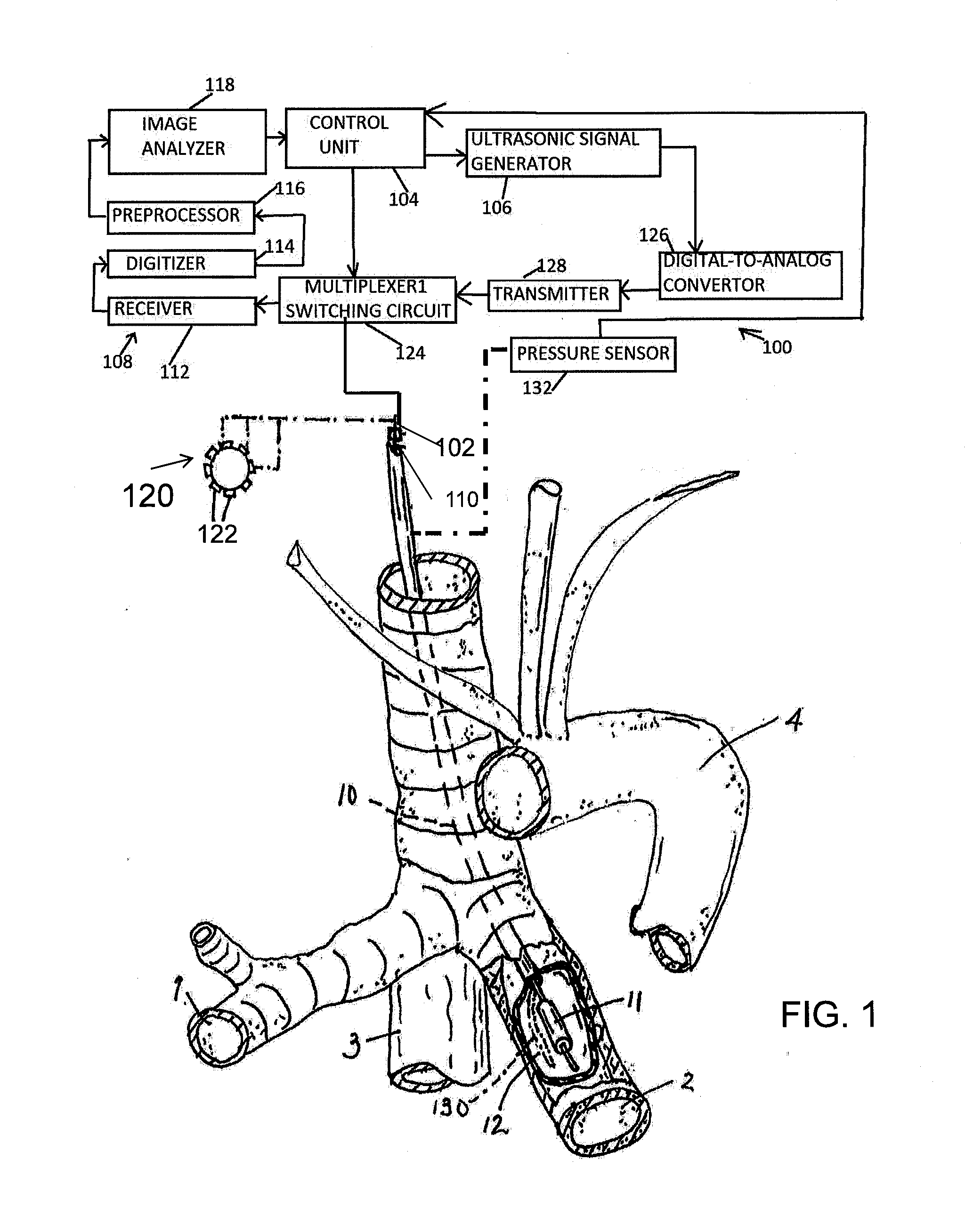 Method and apparatus for performance of thermal bronchiplasty with unfocused ultrasound