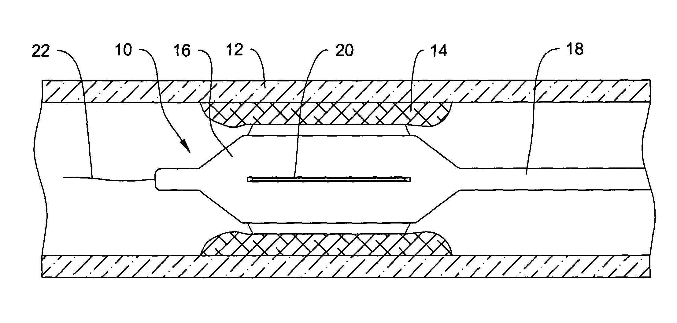 Catheter having a cutting balloon including multiple cavities or multiple channels