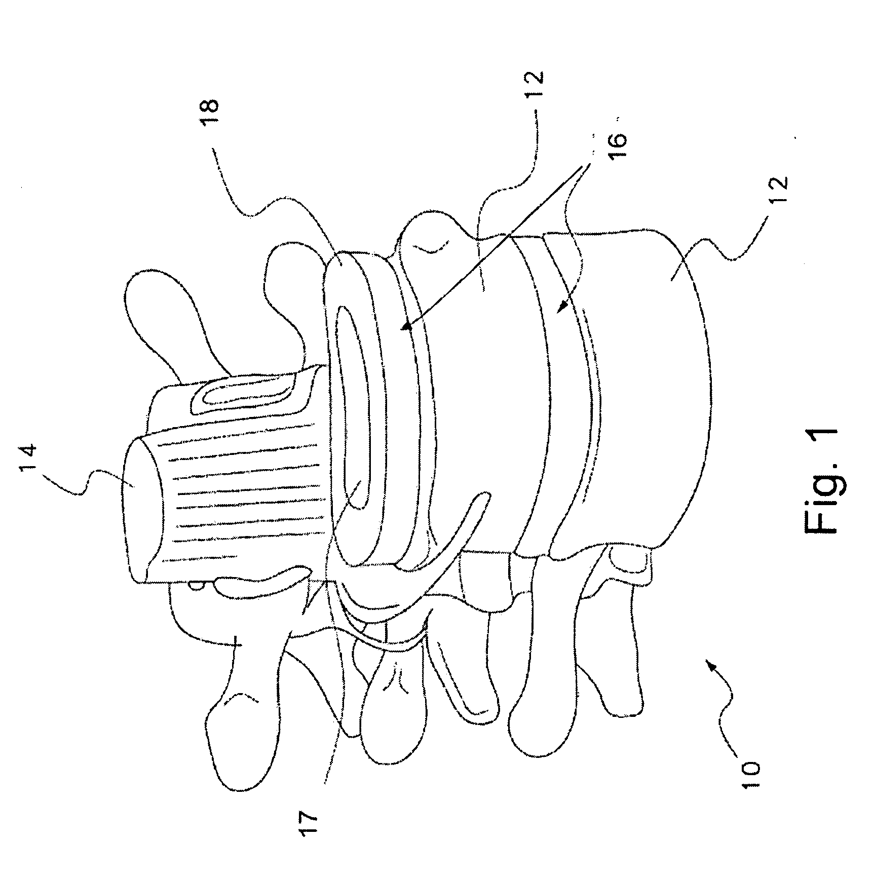 Instrumentation to Facilitate Access into the Intervertebral Disc Space and Introduction of Materials Therein