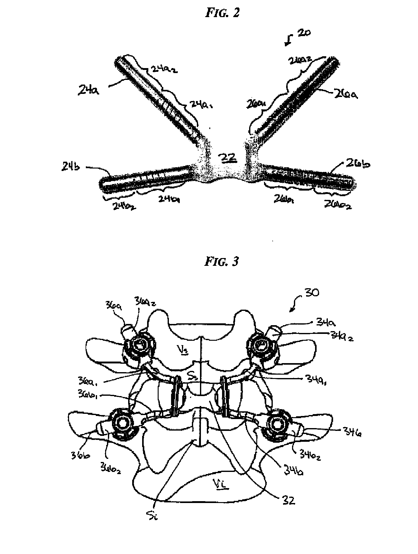 Posterior dynamic stabilization cross connectors