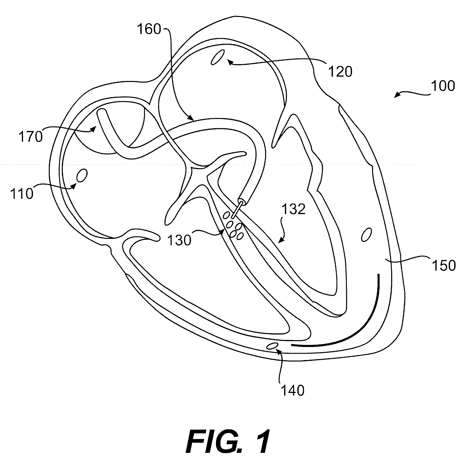 Method For Controlling Pacemaker Therapy