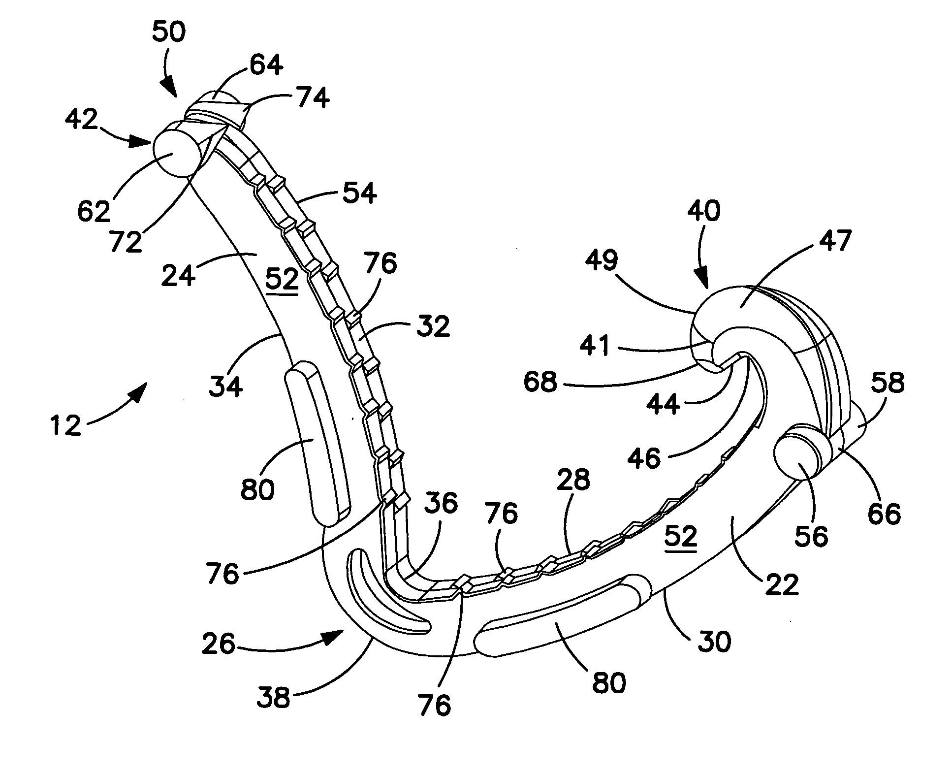 Ligating clip with integral cutting guide