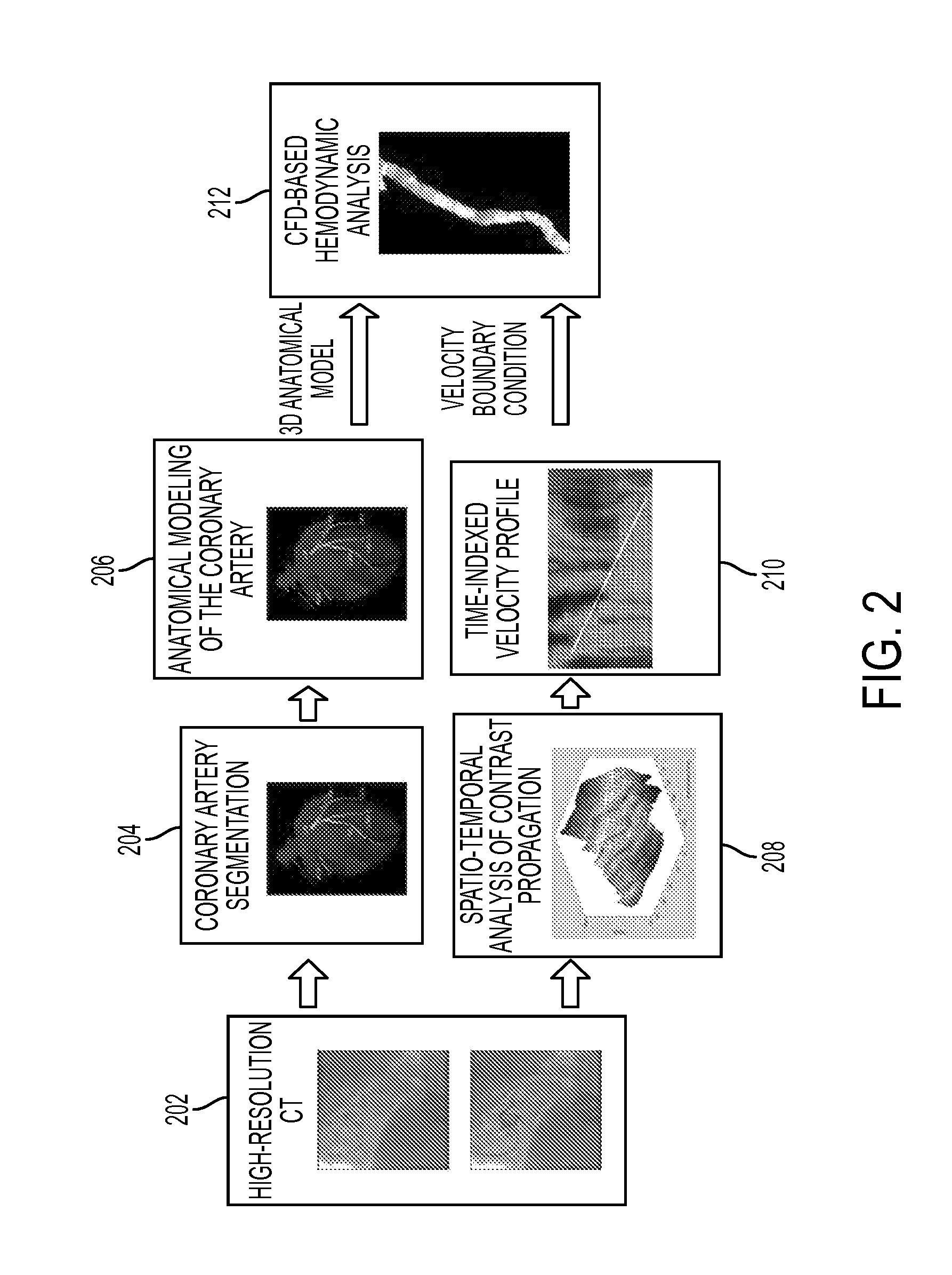Method and System for Non-Invasive Assessment of Coronary Artery Disease