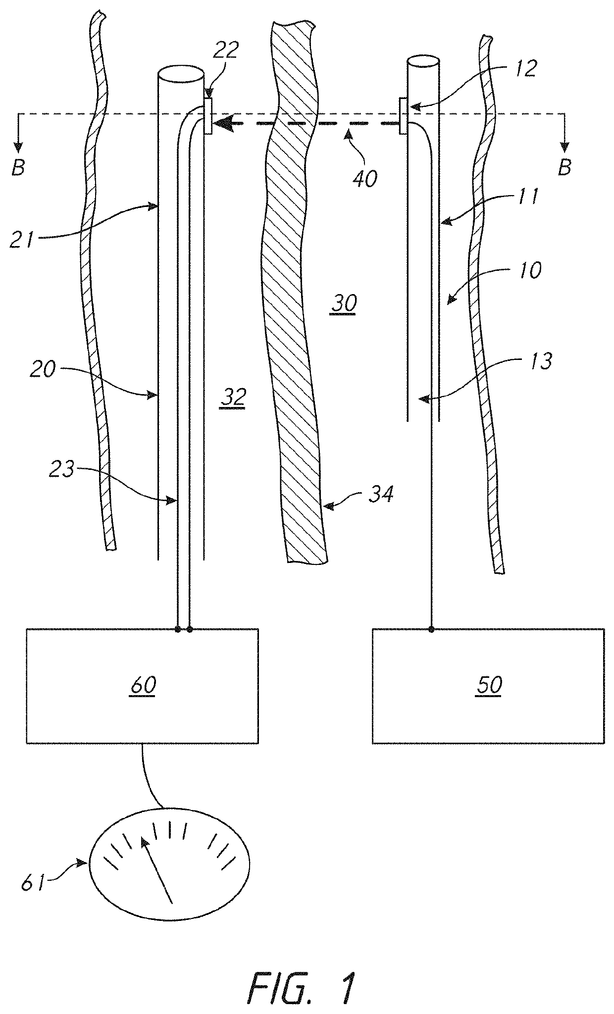 Devices and methods for catheter alignment