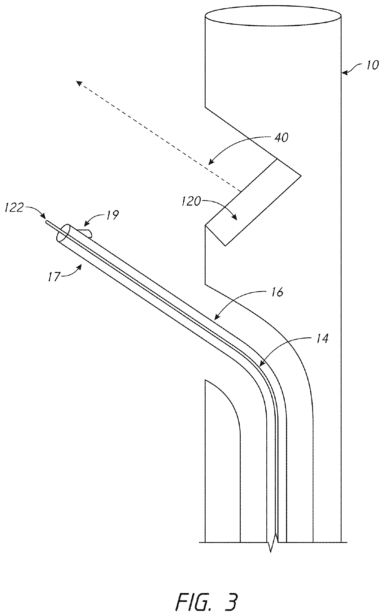 Devices and methods for catheter alignment