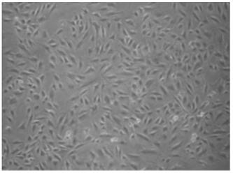 Culture method for transforming human oral mucosal stem cells into astrocytes