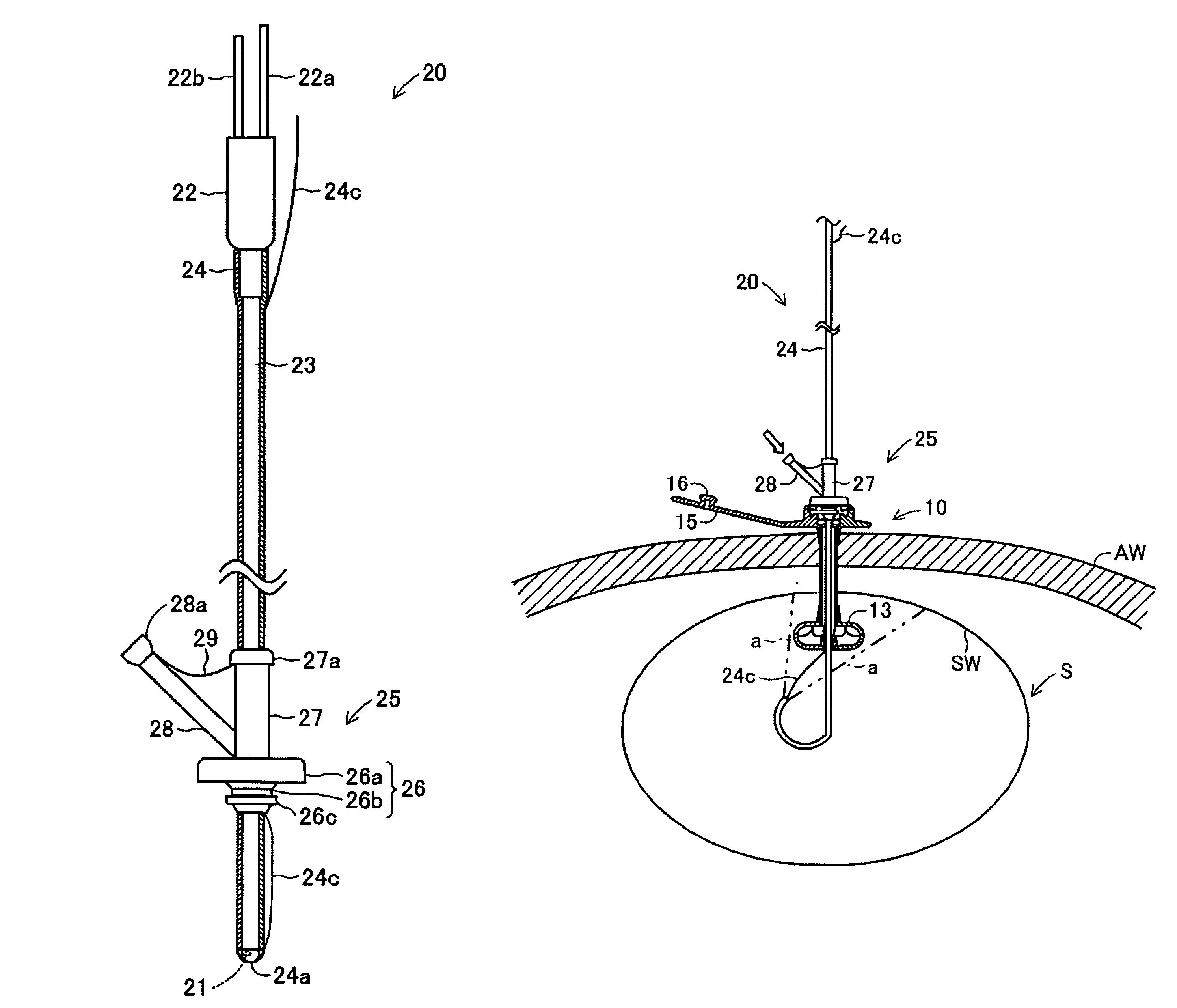 Endoscope system for gastrostomy catheter placement