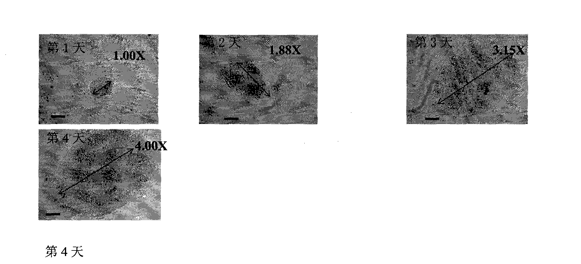 Human embryonic stem cell line with nonrandom inactivated X chromosome and specific short tandem repeats