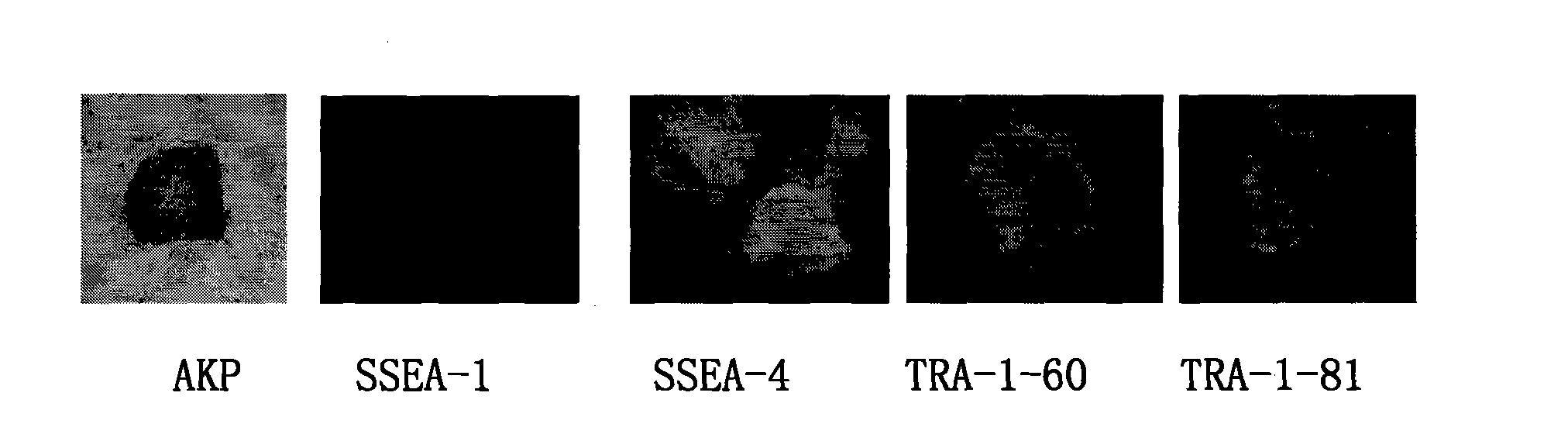 Human embryonic stem cell line with nonrandom inactivated X chromosome and specific short tandem repeats