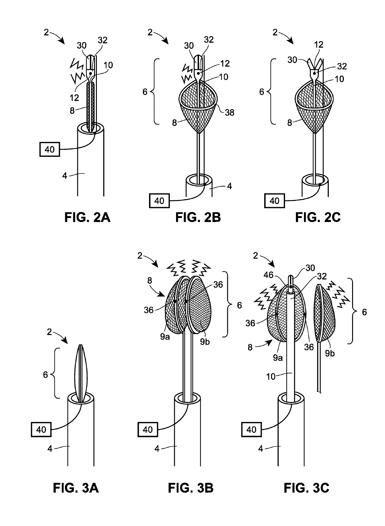 Transapical removal device