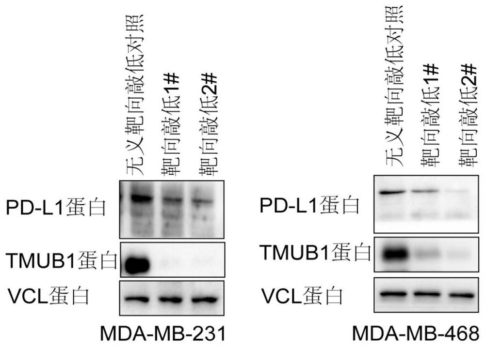 Application of TMUB1 protein in preparation of tumor immunosuppressive molecular detection agent