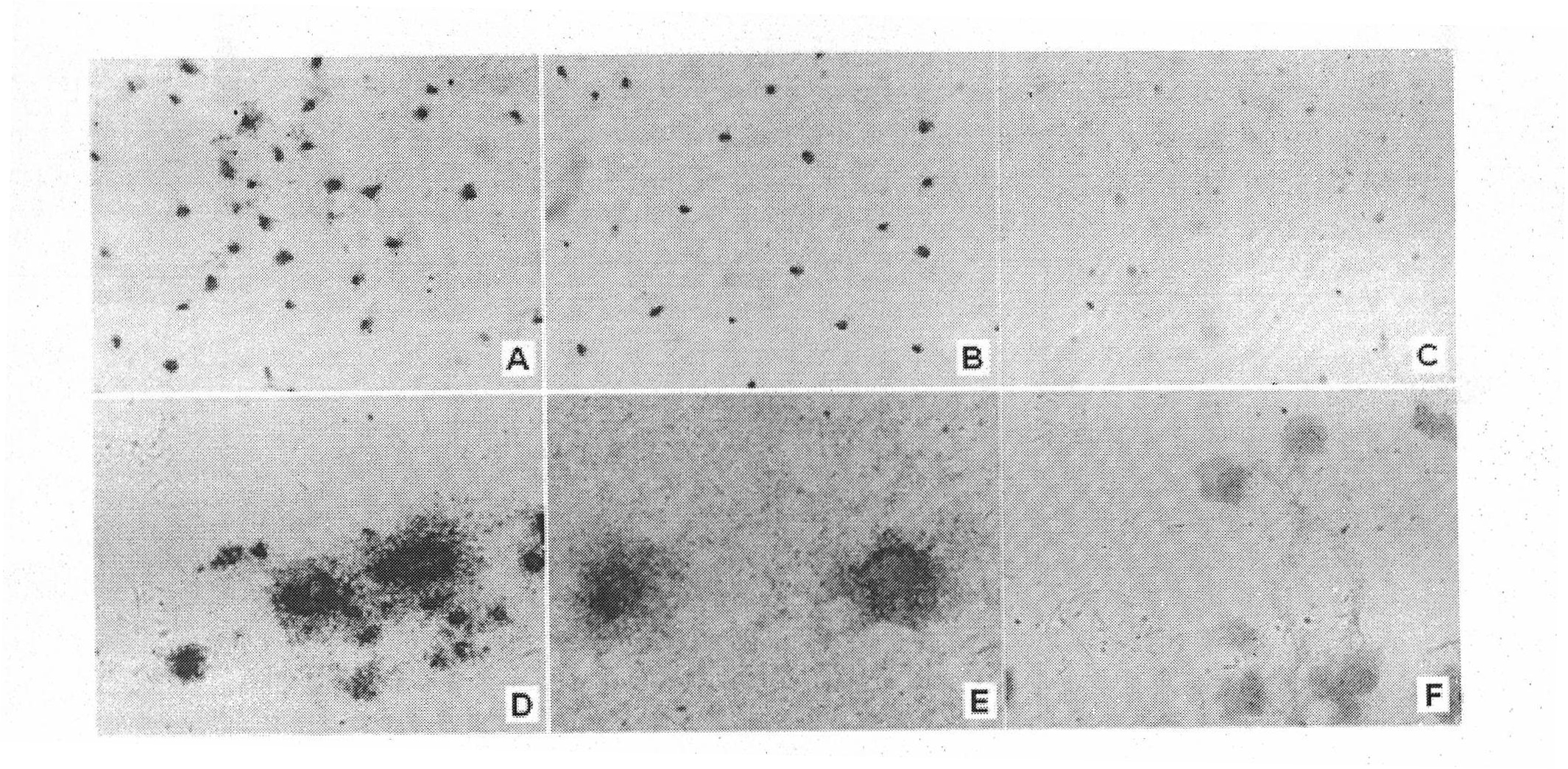 Diagnostic and therapeutic gastric cancer vascular specific binding peptide GEBP11 isotope probe