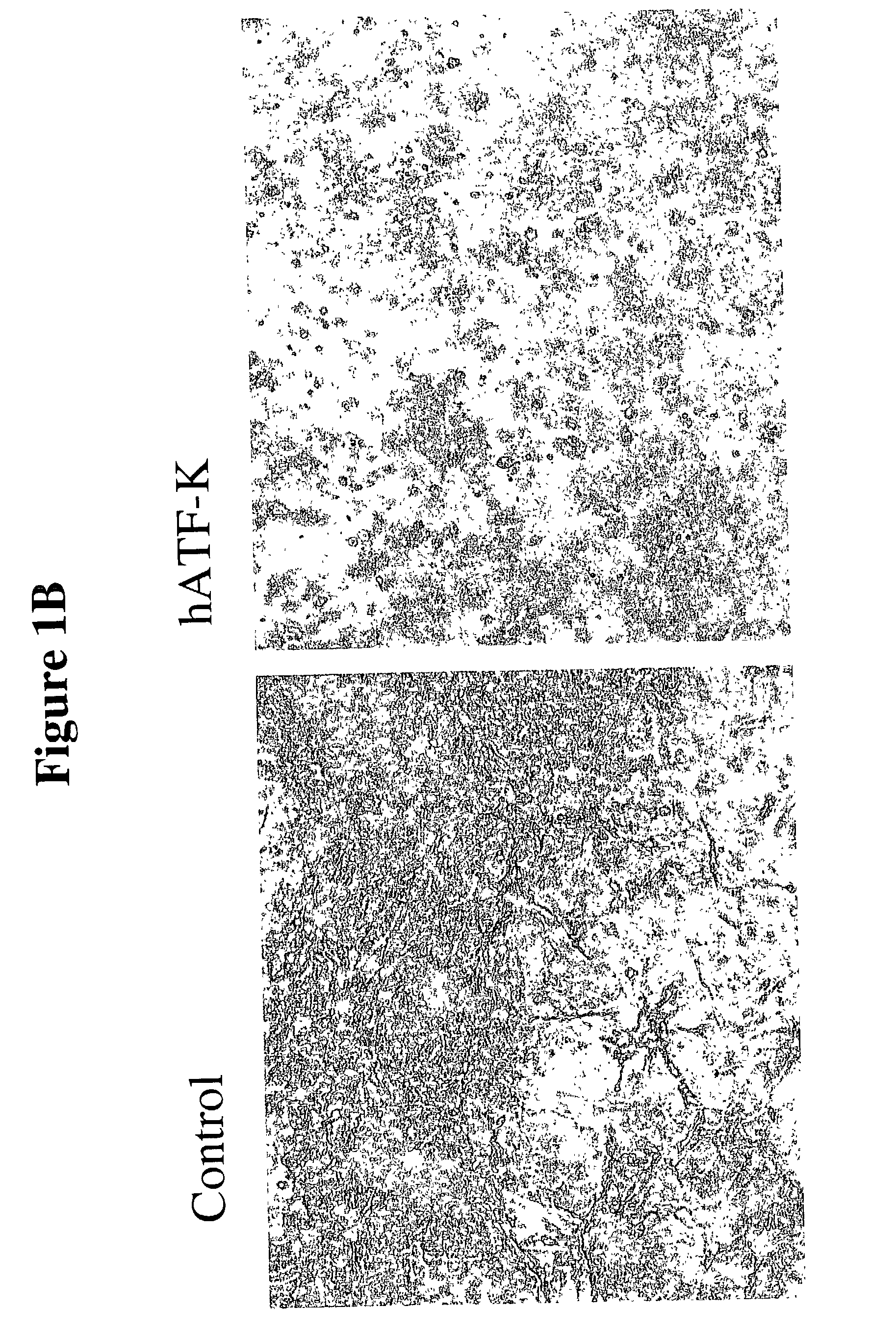 Abrogen polypeptides, nucleic acids encoding them and methods for using them to inhibit angiogenesis