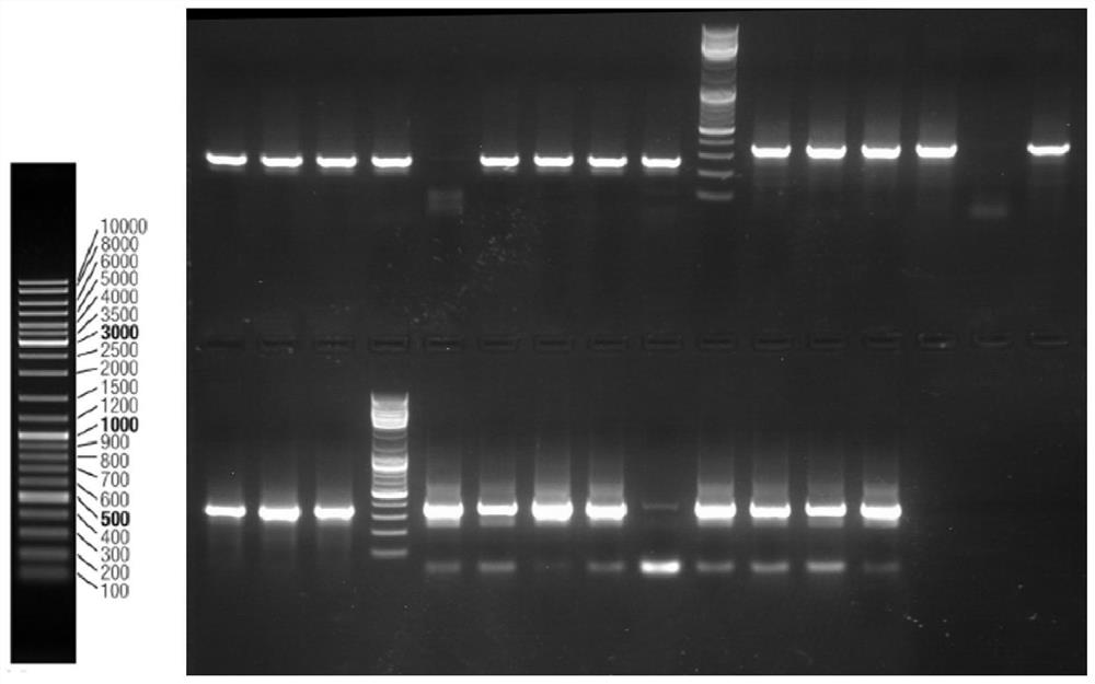 Detection primers, detection kits and applications based on methylation of sox10 gene in peripheral blood