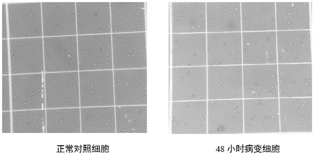 A method for culturing serum-free whole suspension cells of Newcastle disease vii attenuated strain