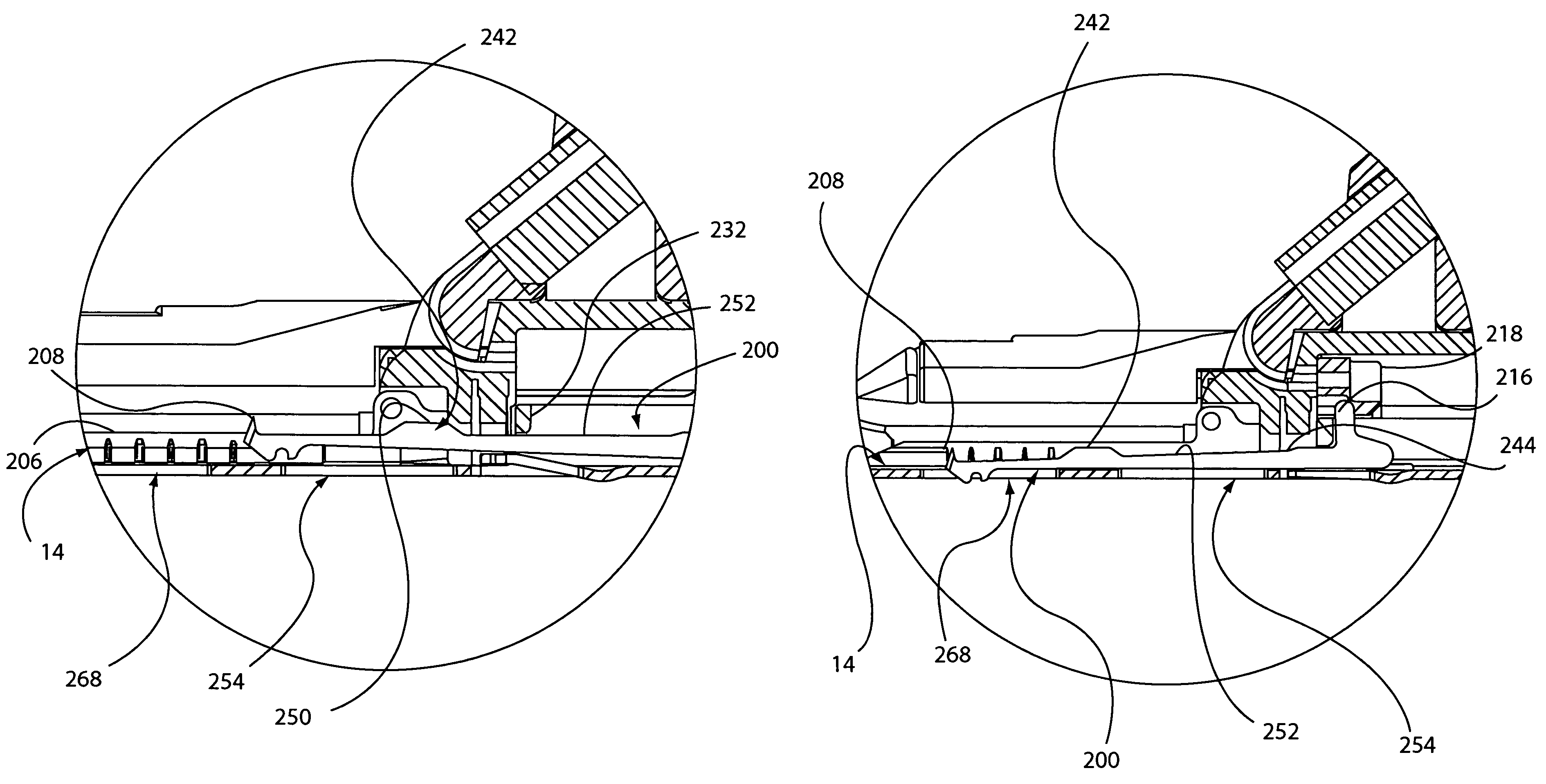System for performing anastomosis