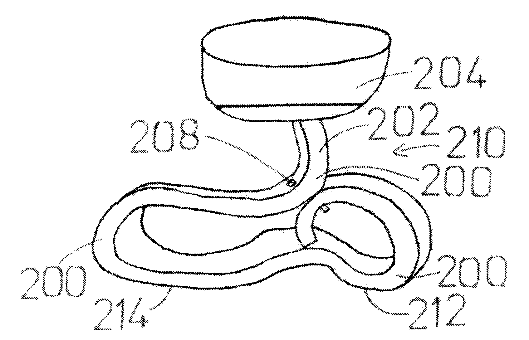 Method of fabricating, artificial limbs incorporating superelastic supports