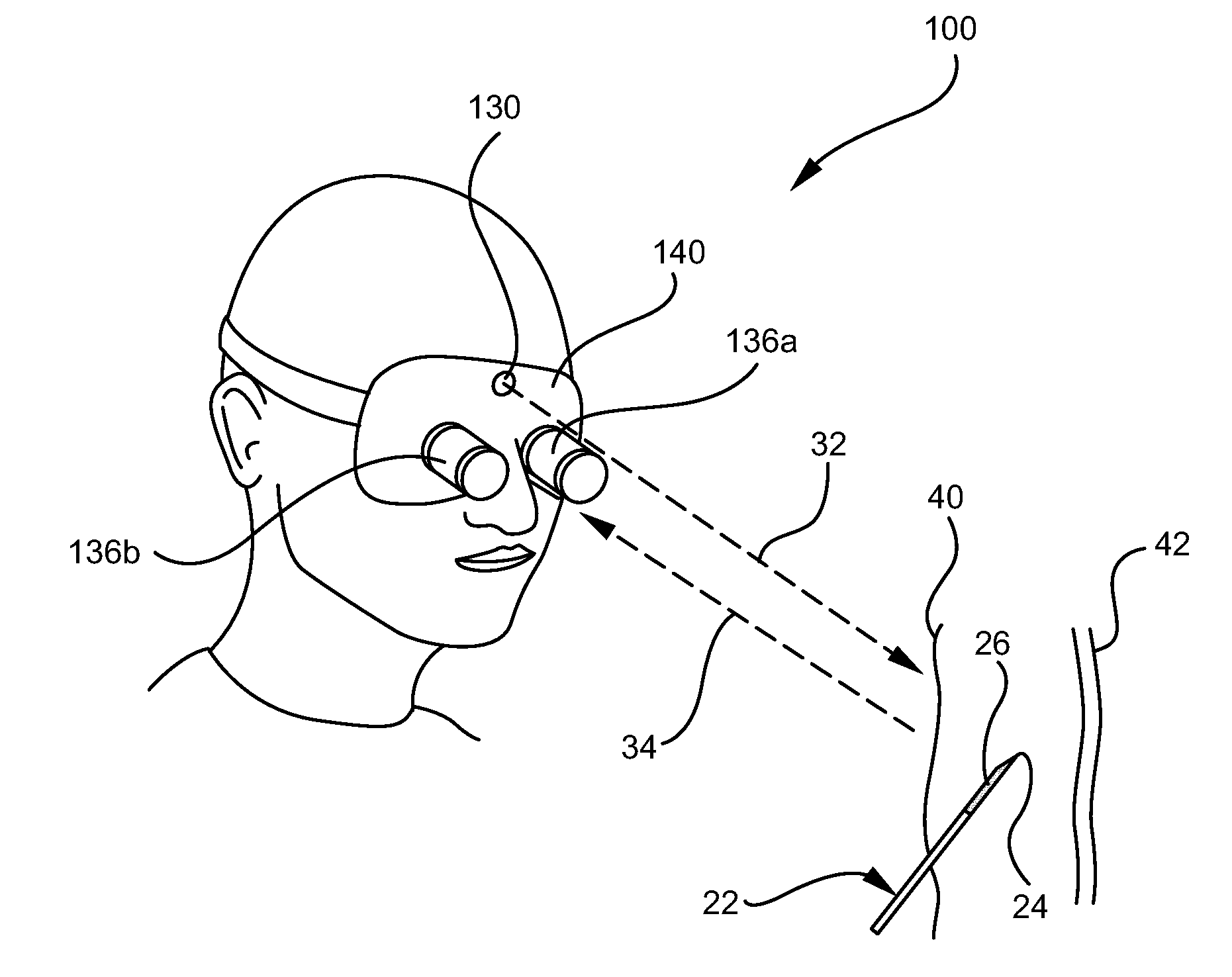 System and method for visualizing needle entry into a body