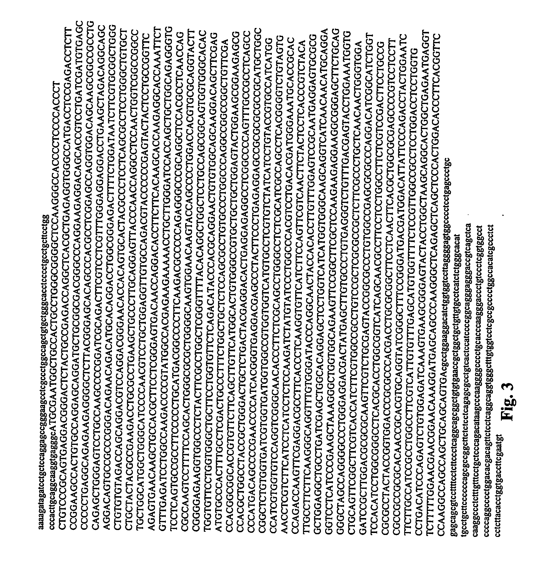 Gene expressed in prostate cancer, methods and use thereof