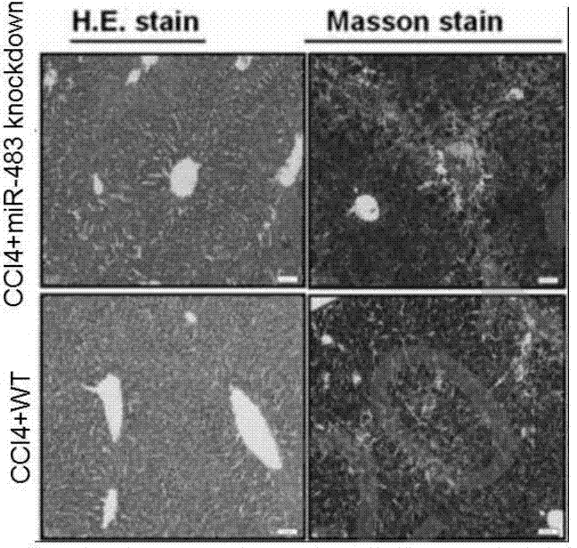 Method of establishing hepatic fibrosis animal fertilized eggs based on micro RNA interference