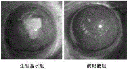 Application of celastrol to preparing eye drop preparation for inhibiting alkali burn corneal neovascularization and promoting corneal alkali burn healing