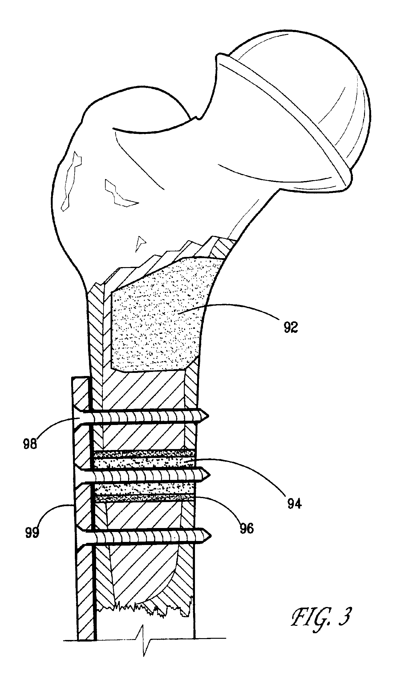 Biologically active composites and methods for their production and use