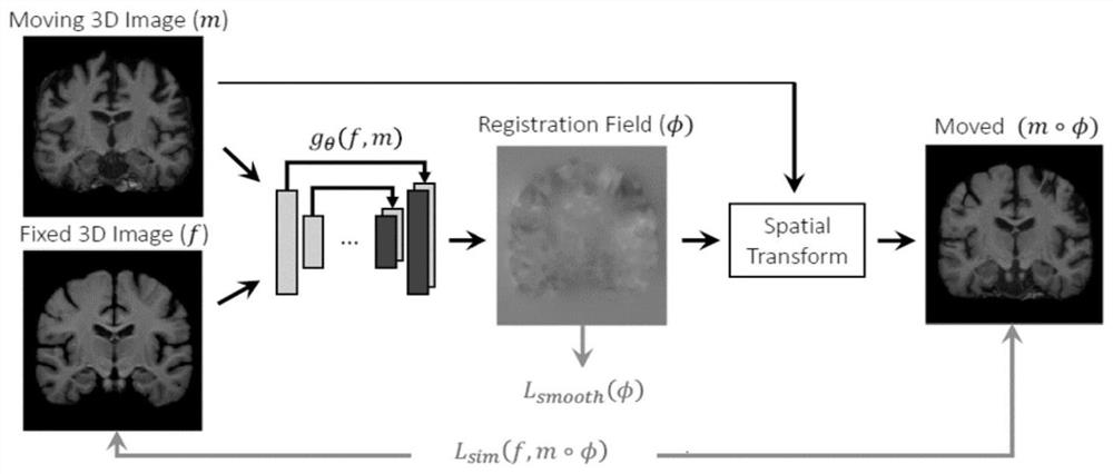 Liquid foreign matter visual detection method and system