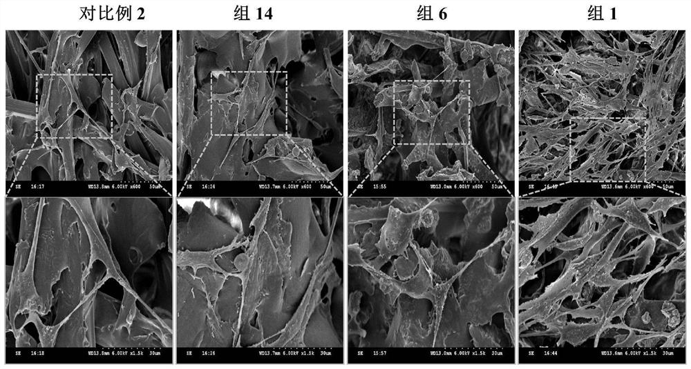 A kind of erosion-resistant osteoinductive silk fibroin/hydroxyapatite/magnesia gel sponge and its preparation method