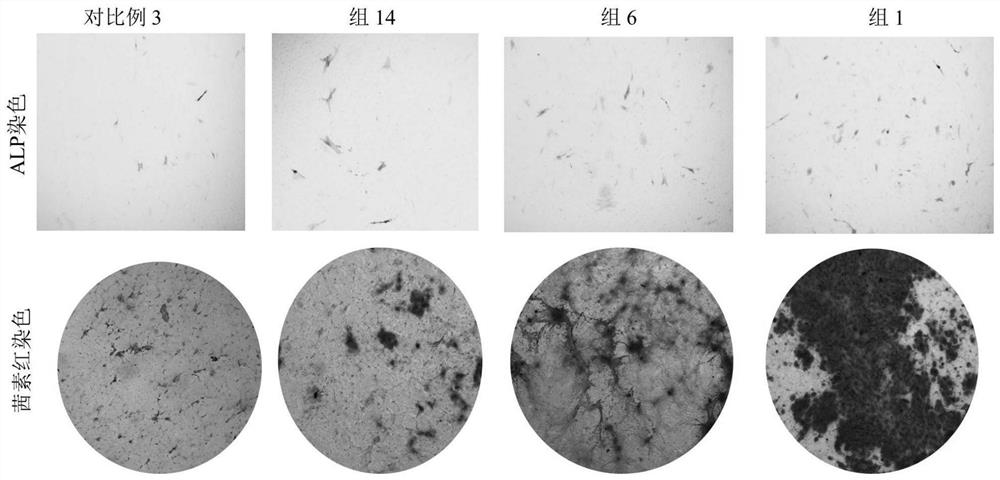 A kind of erosion-resistant osteoinductive silk fibroin/hydroxyapatite/magnesia gel sponge and its preparation method