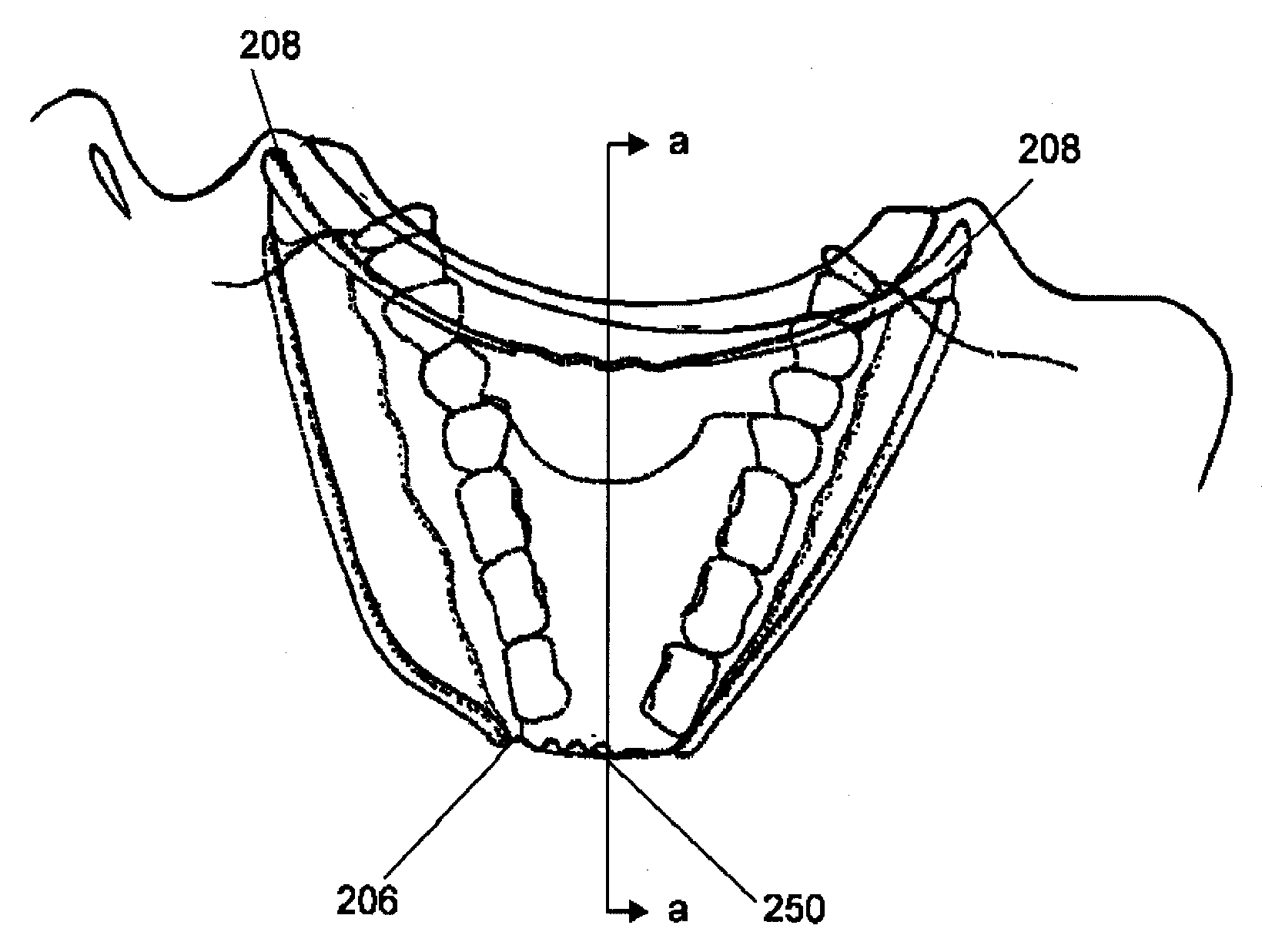 Methods, Devices, Systems and Kits for Isolating Teeth