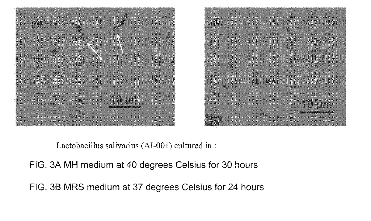 Method for producing lactic acid bacteria controlling m cells