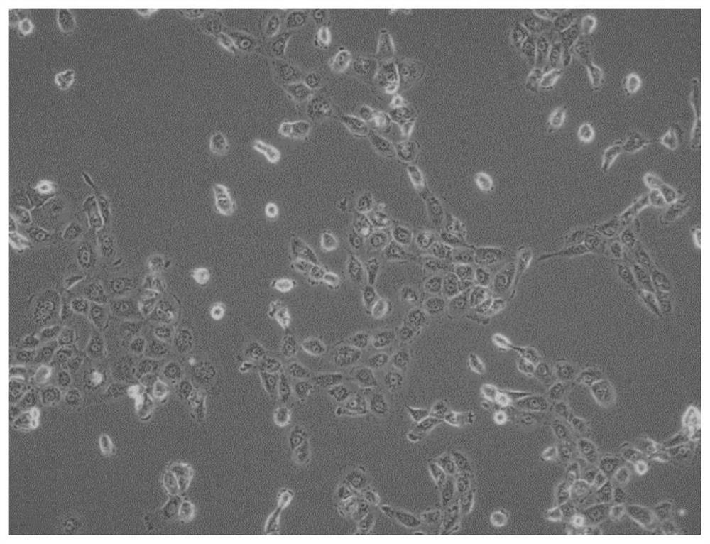 Chinese lung squamous carcinoma cell line and application thereof