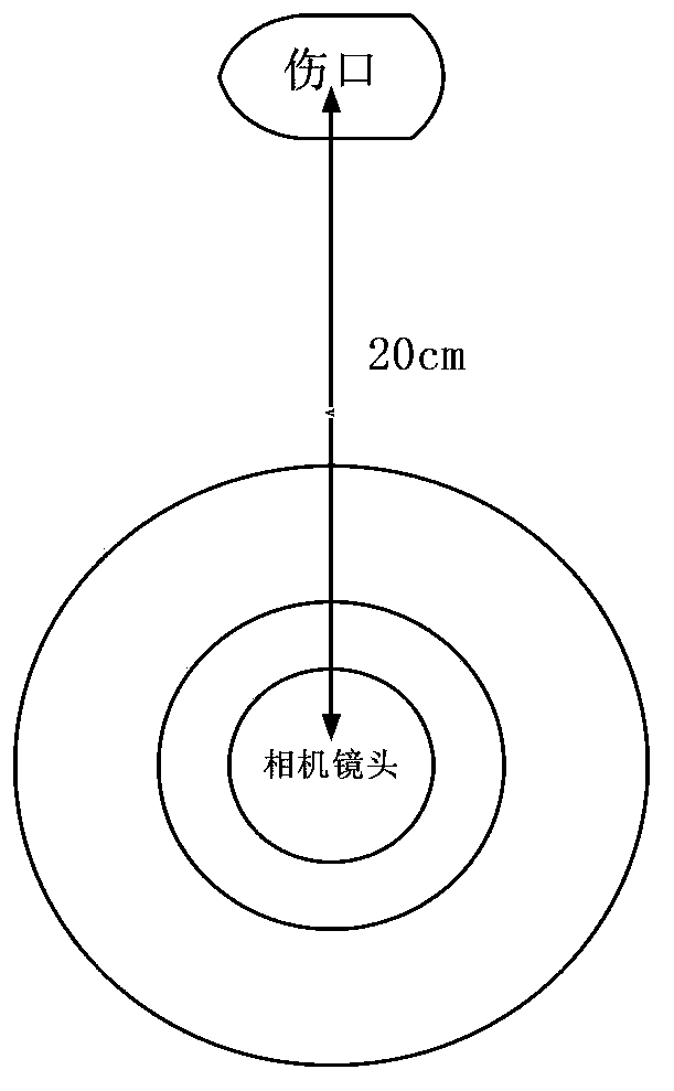 Mobile terminal and method for shooting wound picture through mobile terminal to process injuries