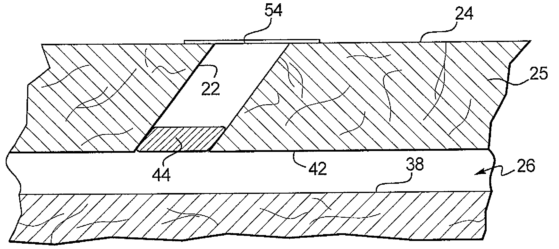 Apparatus and Method for Closing an Opening in a Blood Vessel Using Memory Metal and Collagen