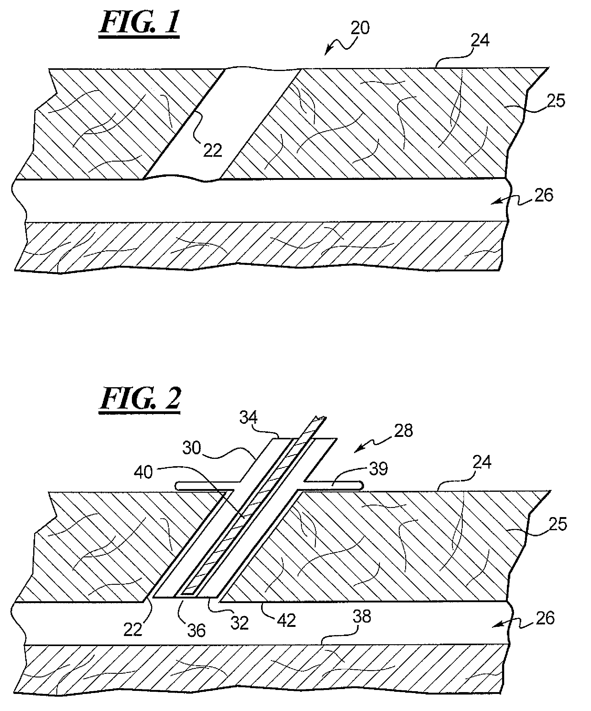 Apparatus and Method for Closing an Opening in a Blood Vessel Using Memory Metal and Collagen
