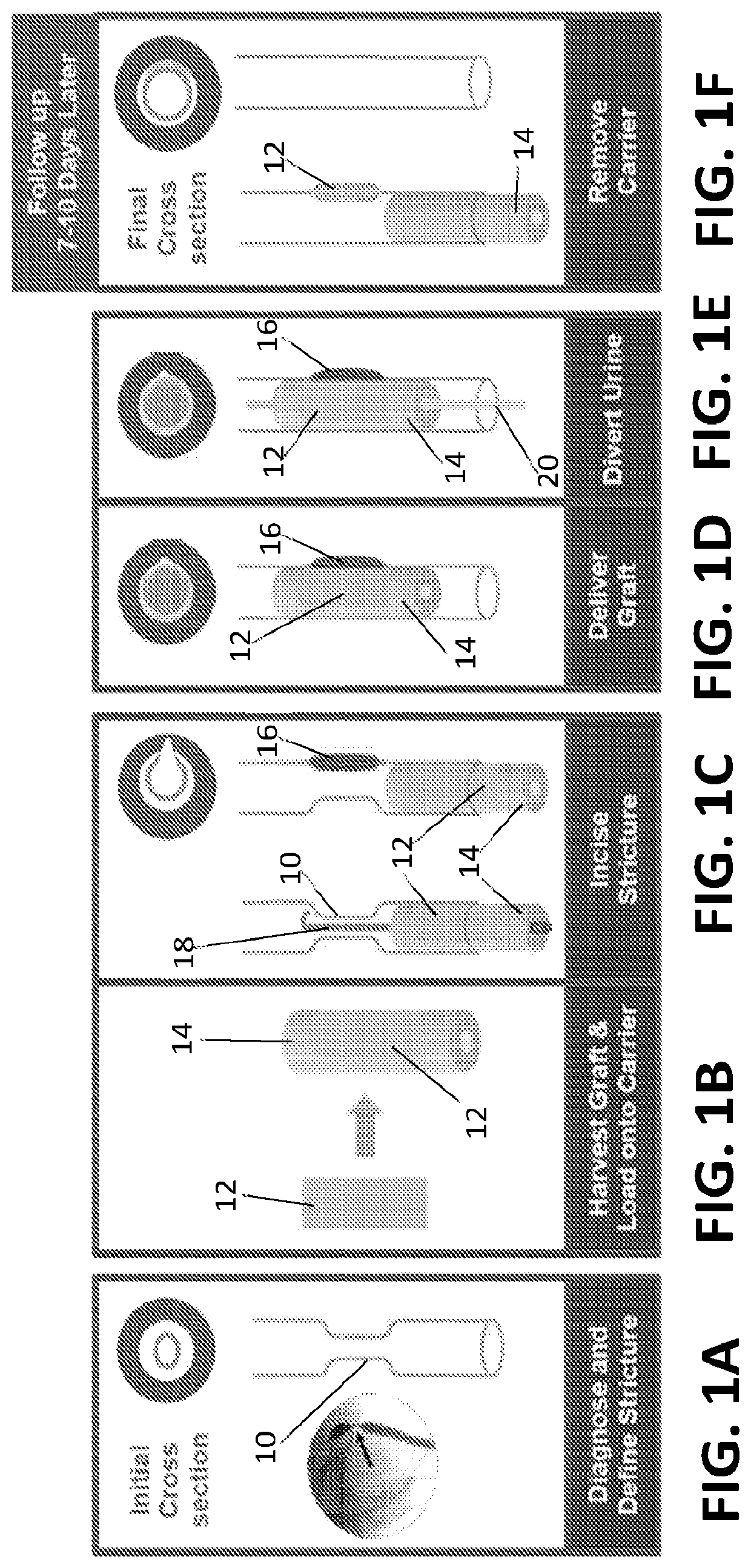 Tools for transurethral deployment and fixation of graft for the management and treatment of urethral strictures