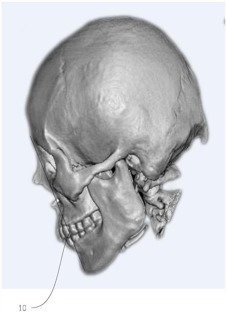 Skull slice acquisition method, device, storage medium and electronic equipment