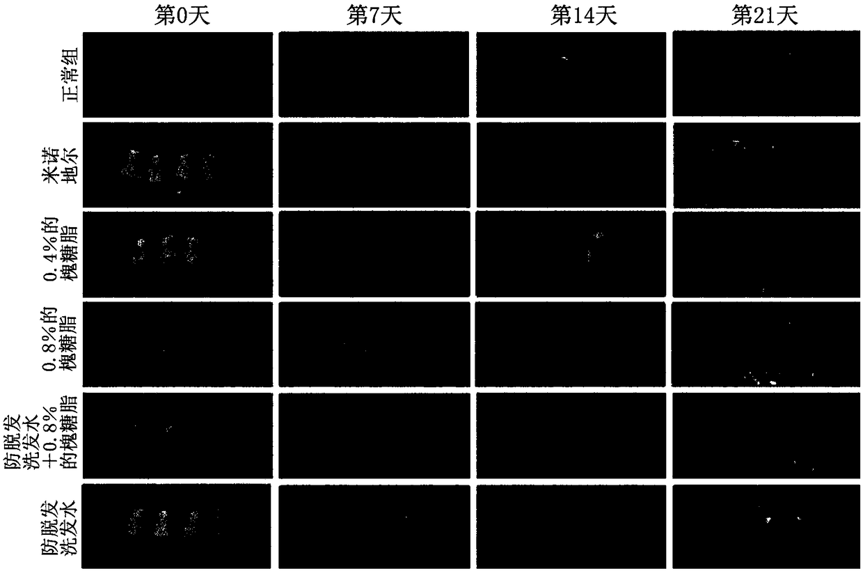 Composition for preventing hair loss or stimulating hair growth comprising sophorolipid as effective component