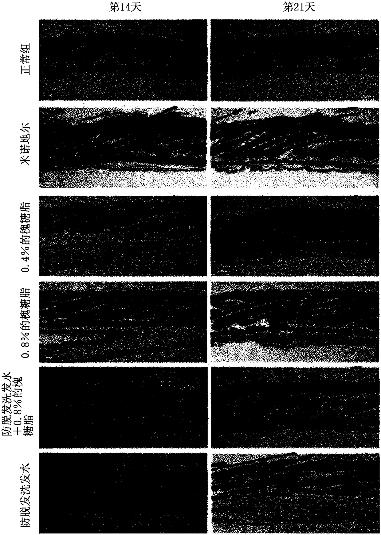 Composition for preventing hair loss or stimulating hair growth comprising sophorolipid as effective component