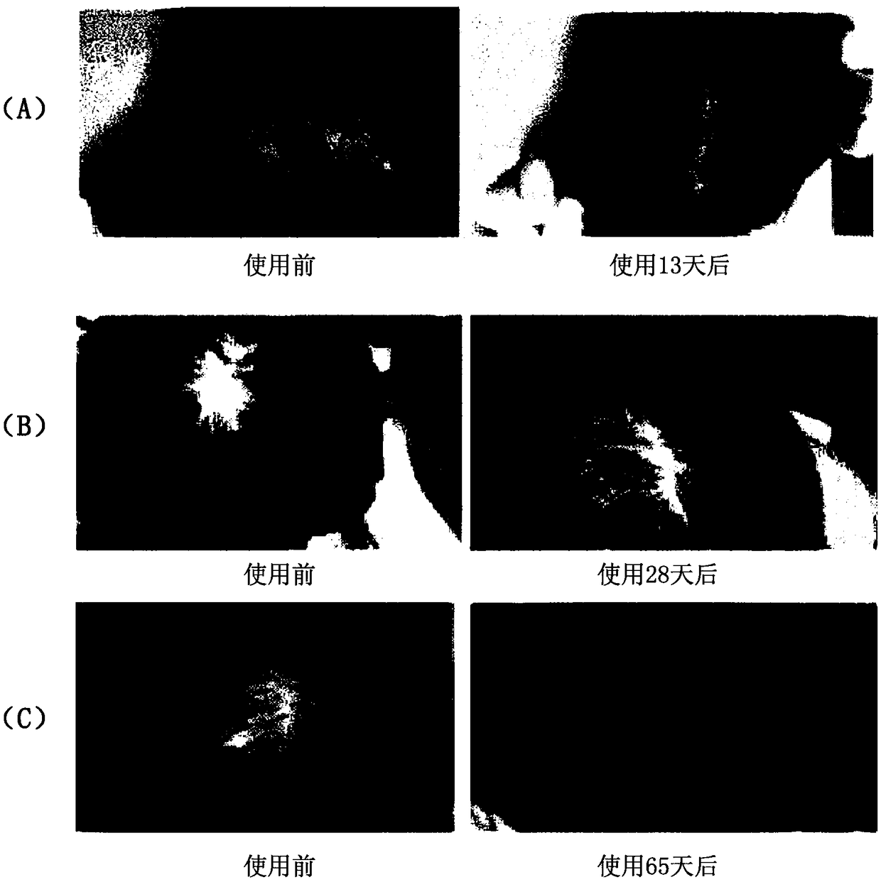 Composition for preventing hair loss or stimulating hair growth comprising sophorolipid as effective component